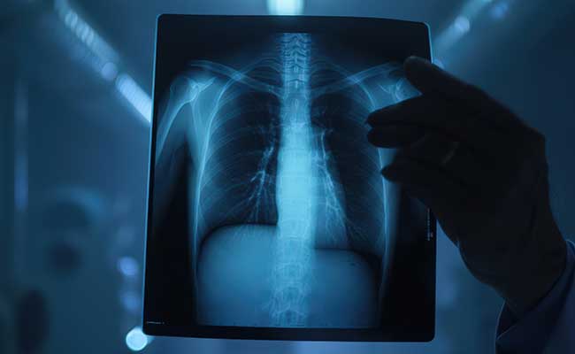 what-is-xray