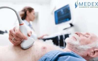 carotid Artery ultrasound