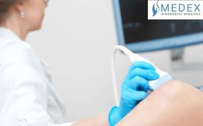 Portable Ultrasound for Leg Discoloration