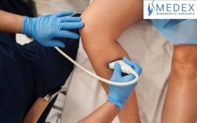 Portable Vascular Ultrasound