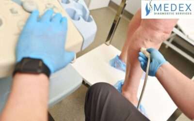 thrombosis Ultrasound